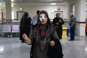 sokak kopegi dehseti resim