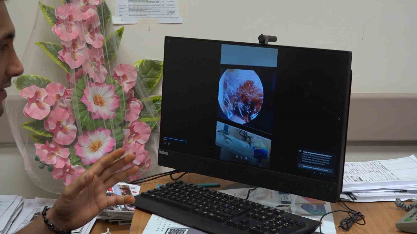 kulaktaki kene cikarildi