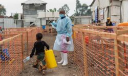 mpox virusu