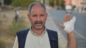 thumbs b c 027616f90ac7bd4bf04048279650fca7