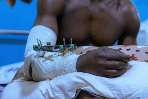 2026 02 19t170118z 1692578260 rc2eojazr8ek rtrmadp 3 burkina ghana security hospital