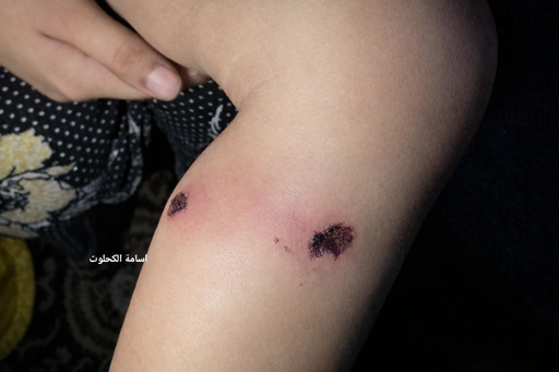 378c1975fcbe1c941d45af4bdefdd3c37773317eb61caa008d5c740fd28af47a